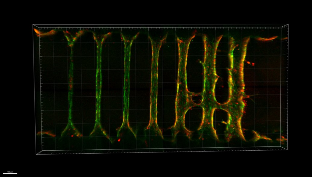 Vessel-on-a-chip